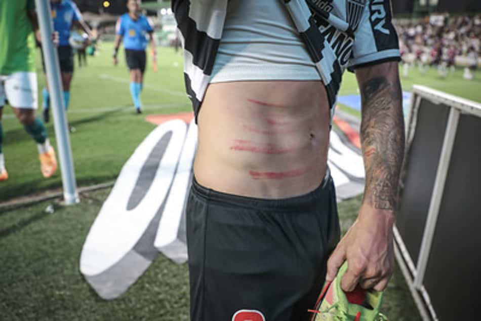 Atlético-MG 'detona' VAR no jogo com o Goiás e chama arbitragem de vídeo de 'esdrúxula'