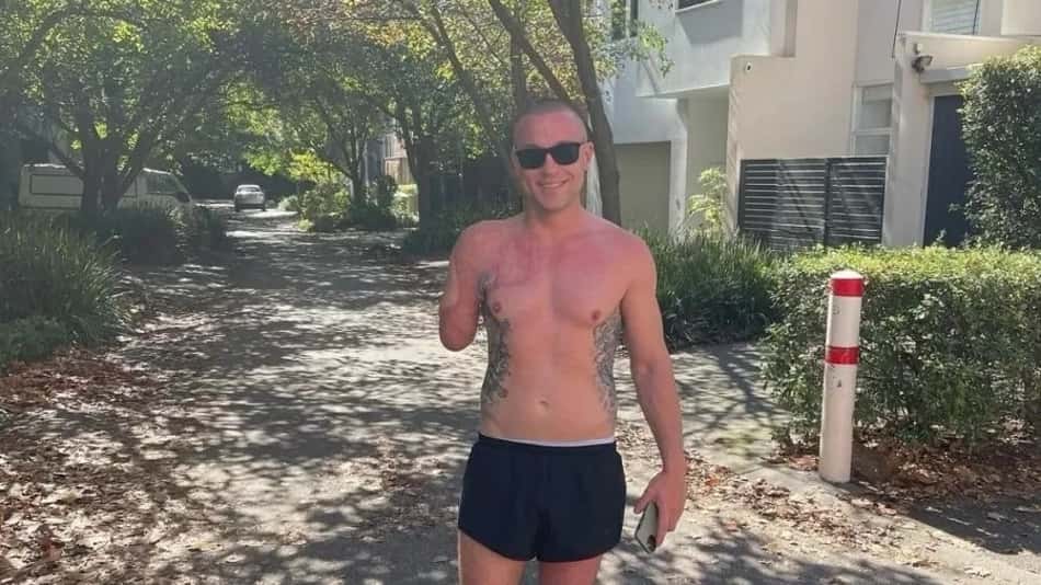 Atleta australiano contrai bactéria após cirurgia e tem braço amputado