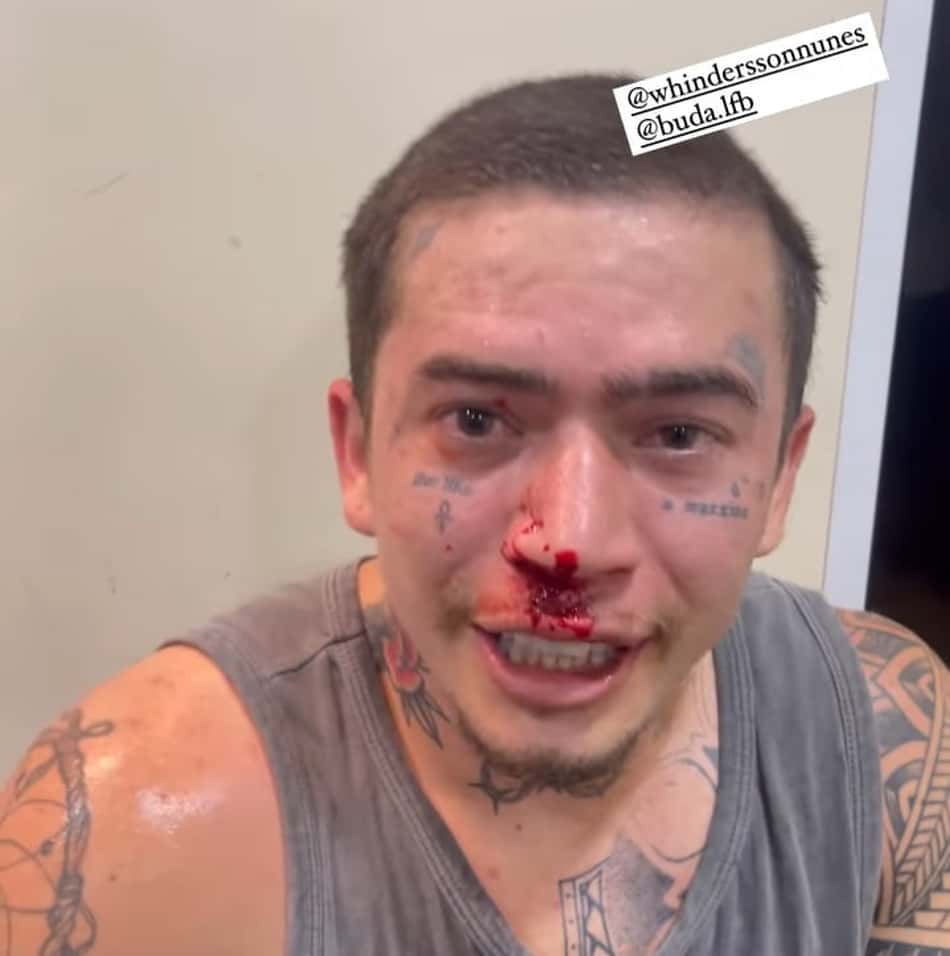 VÍDEO: Whindersson Nunes fica com nariz sangrando após treino de boxe