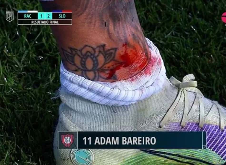 Imagem forte! Jogador leva entrada do adversário e sai machucado do lance