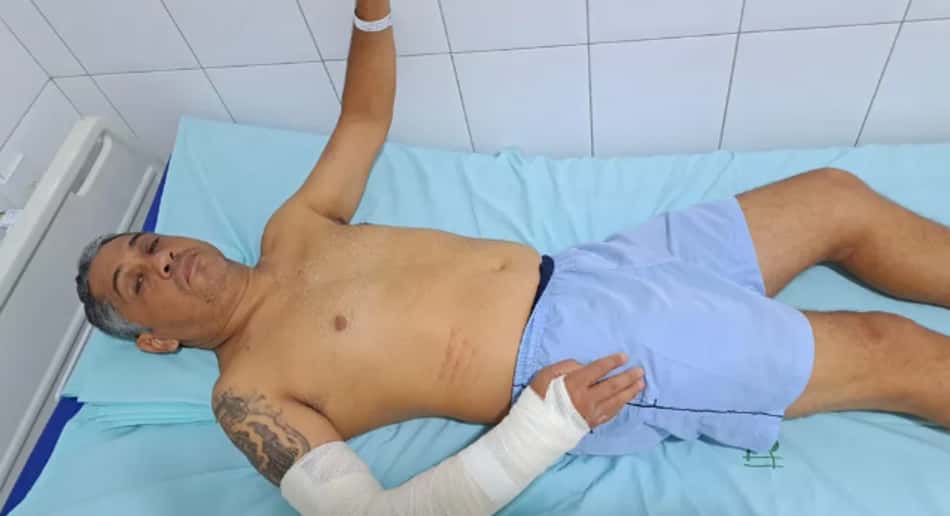 Árbitro tem pulso quebrado ao ser agredido por jogador