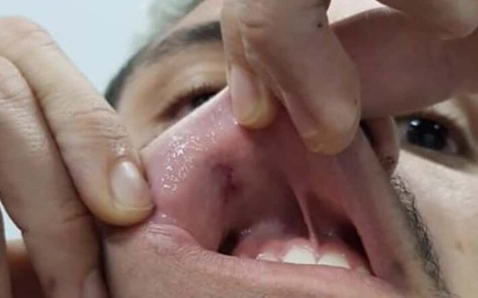 Imagem forte: veja detalhes do boletim de ocorrência feito por Pedro