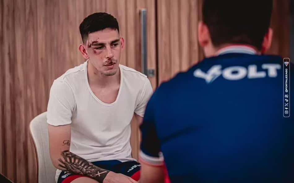 Jogadores do Fortaleza apresentam mais de 1200 lesões após ataque