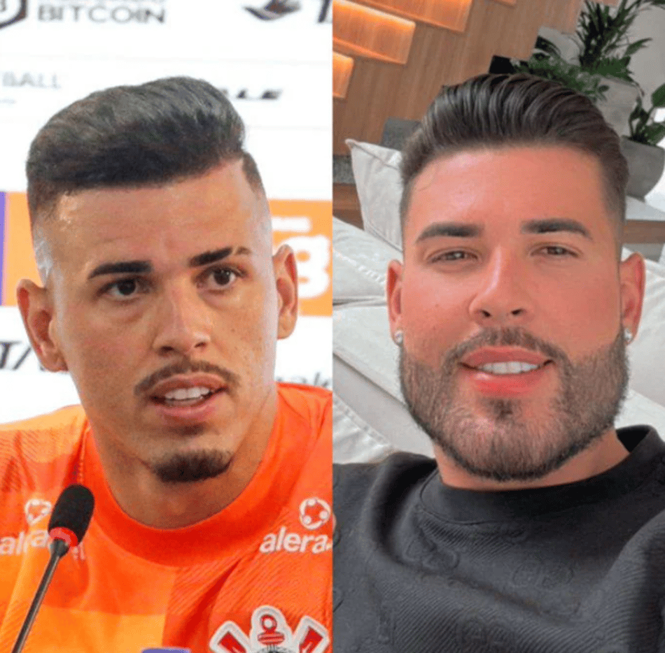 O resultado da harmonização facial do goleiro Ivan Quaresma, do Internacional