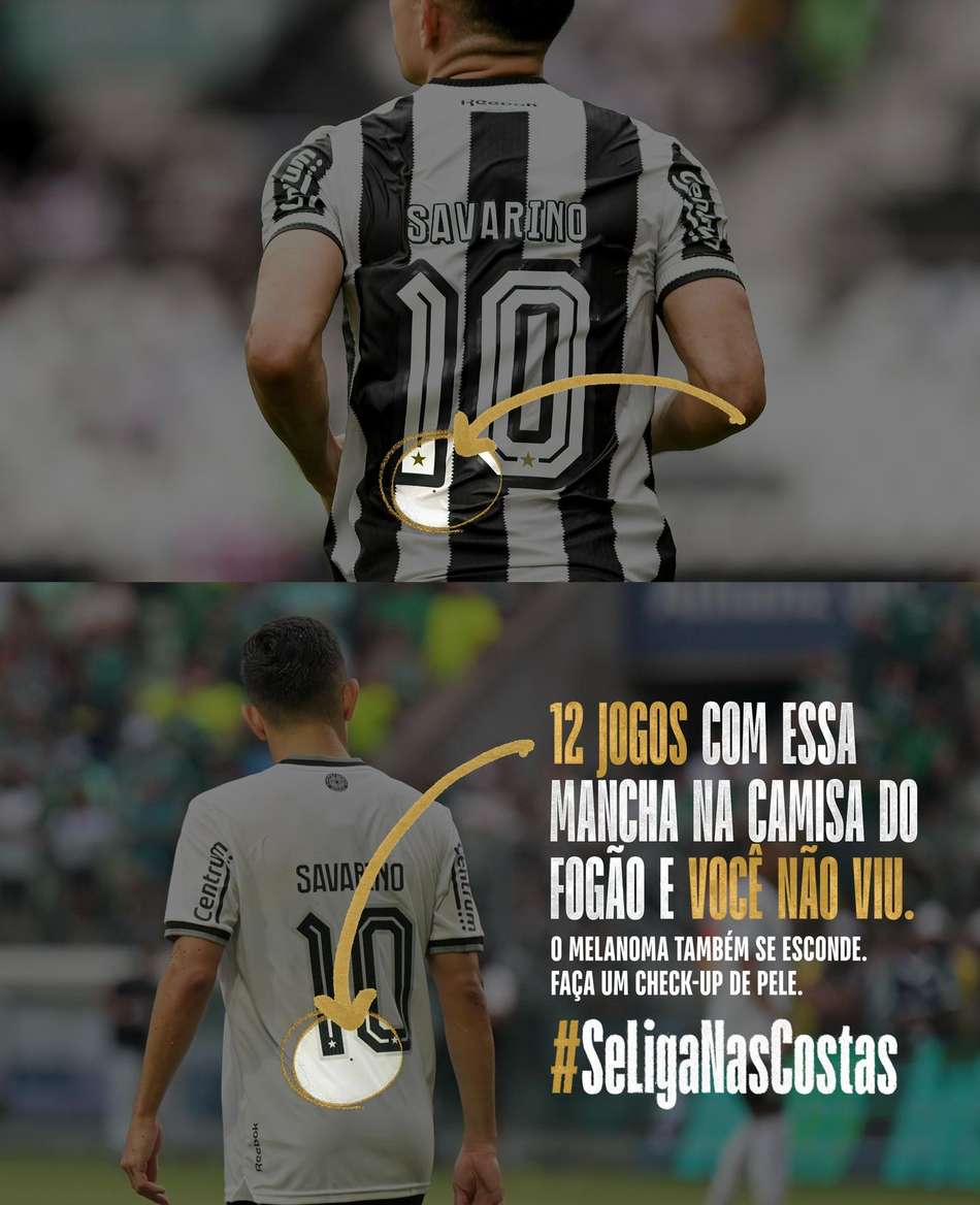 Camisa do Botafogo com mancha conscientiza sobre o melanoma