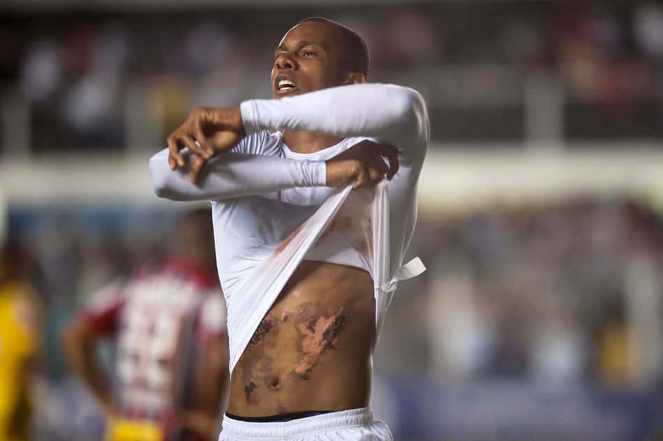 Copete mostra ferimento na barriga após marcar três gols contra o São Paulo, em 2017. (Foto: Ivan Storti/Santos FC)