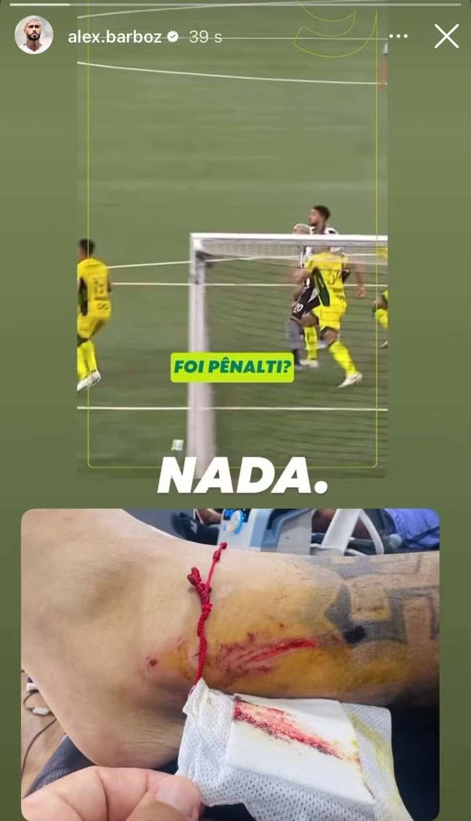 barboza-botafogo-machucado-mirassol