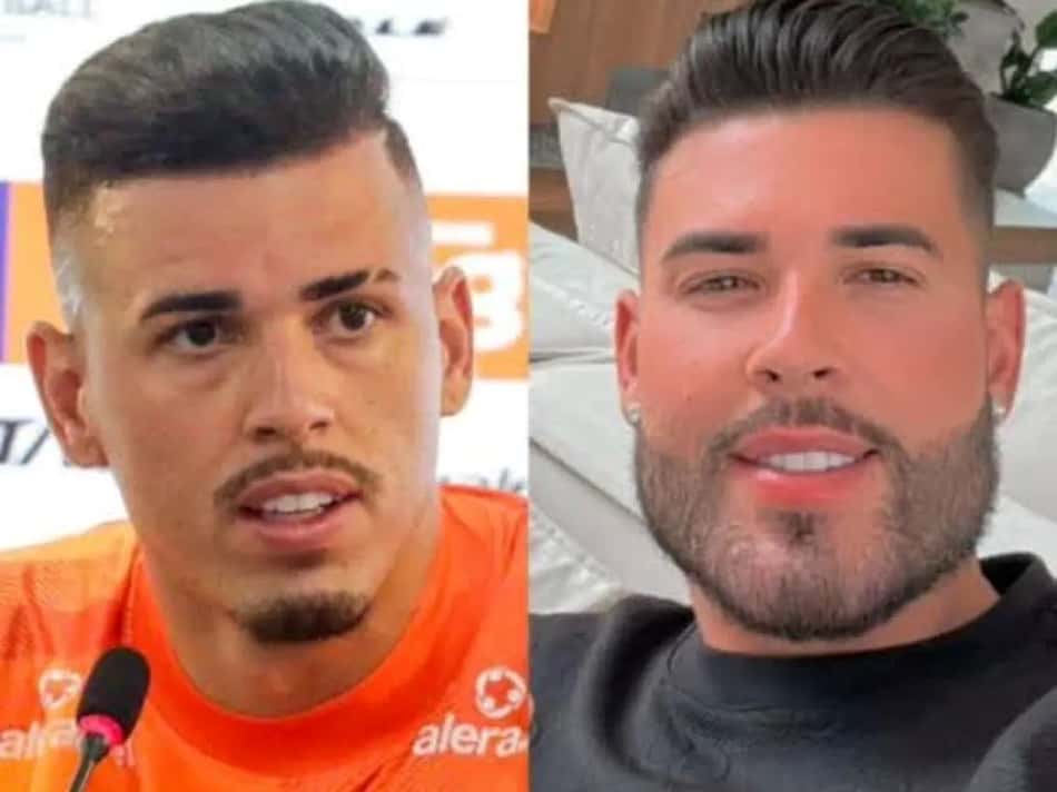 Harmonização facial de Ivan, goleiro do Remo (Foto: Reprodução)