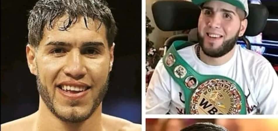 Prichard Colón antes e depois dos golpes ilegais na nuca (Foto: Reprodução)