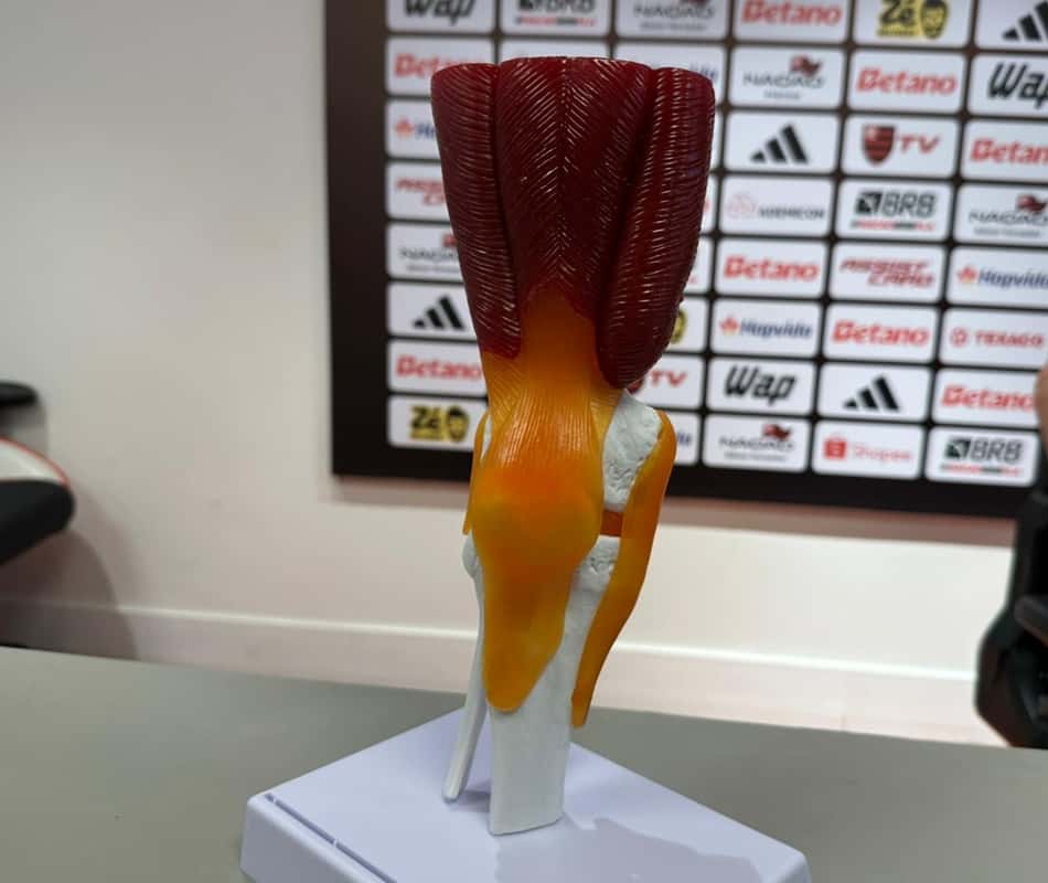 Região onde clube russo alega que há lesão em Gonzalo Plata