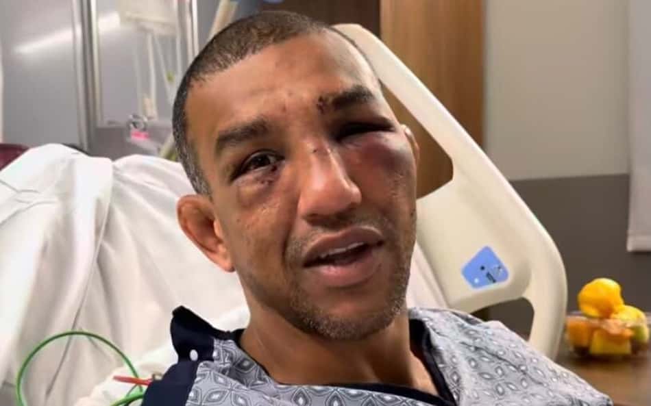 Do hospital e com o rosto inchado, o lutador brasileiro Raoni Barcelos fala em vídeo direcionado a fãs preocupados com seu estado de saúde