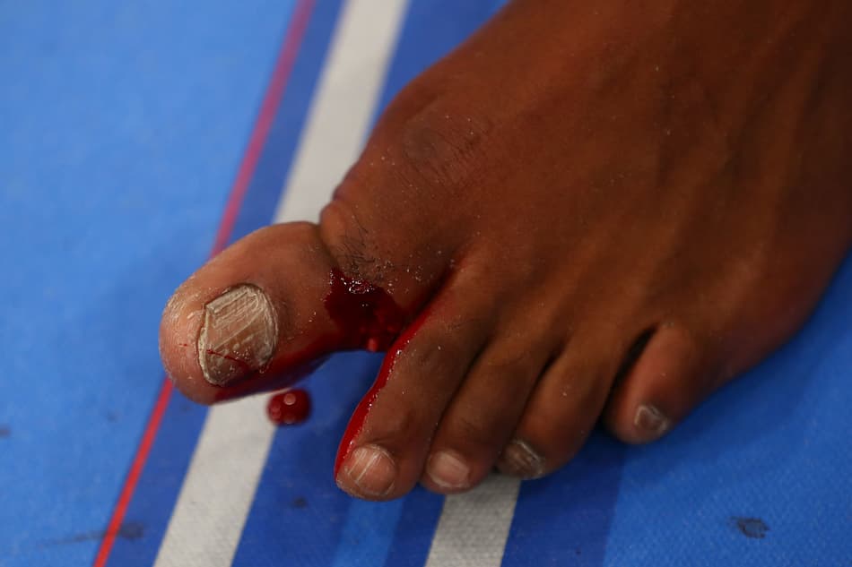 Jon Jones quebra o dedão do pé esquerdo na disputa de cinturão do UFC 159 (Foto: Getty Images)