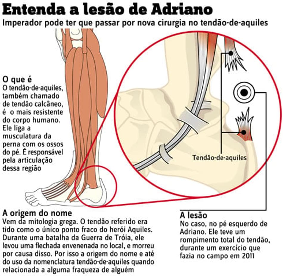 INFO - Lesão no tendão-de-aquiles de Adriano