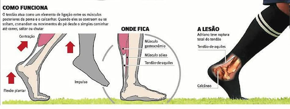 Infográfico - Lesão Adriano