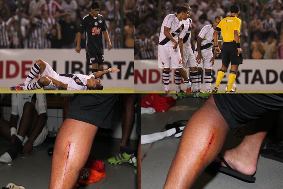 Diego Souza admite ter perdido a cabeça contra o Libertad