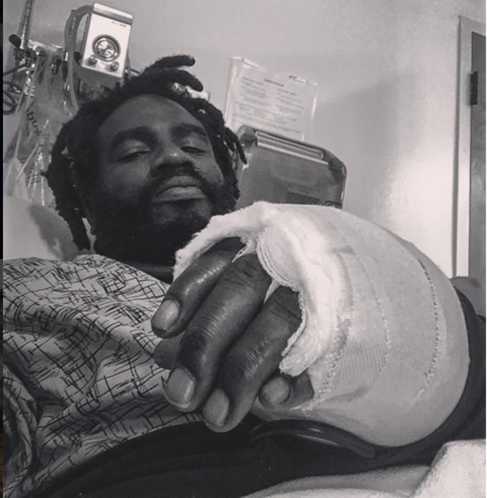 Imagem forte! Campeão do Bellator divulga foto de cirurgia na mão