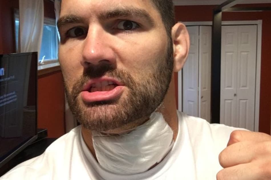 Weidman