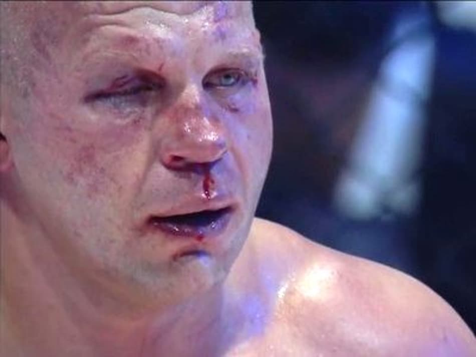 Fedor