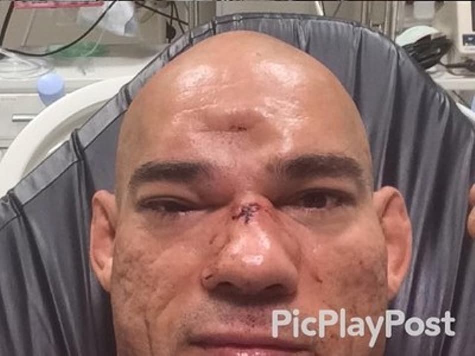 Cyborg: ‘Após nocaute, Evangelista diz que volta a lutar em três meses’