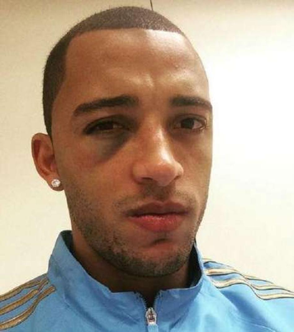 Vitor Hugo supera choques de cabeça, adia Europa e fica perto do 100º jogo