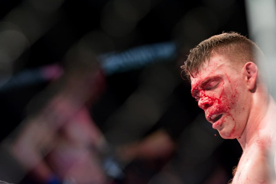 Imagem forte! Vítima de brasileiro sofre corte profundo no UFC Brasília