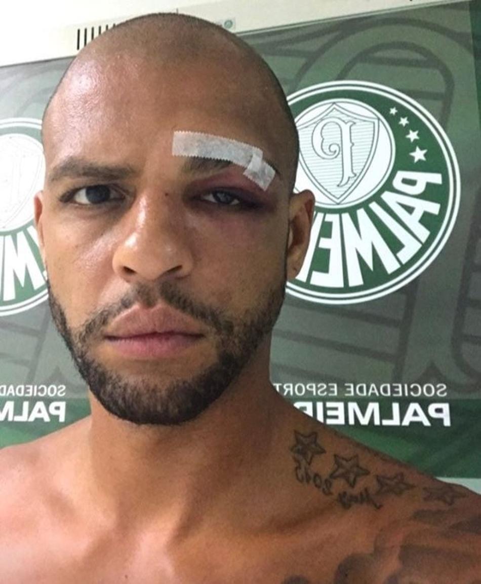 Pressionado, Eduardo Baptista tem de se virar sem três pilares do meio