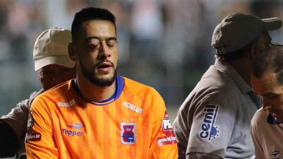 Goleiro Léo sofre fratura no rosto e pode desfalcar o Paraná por dois meses