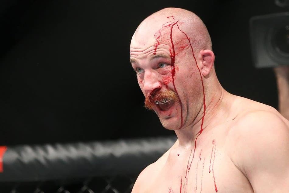 Lutador do UFC mostra inchaço assustador após vitória no octógono