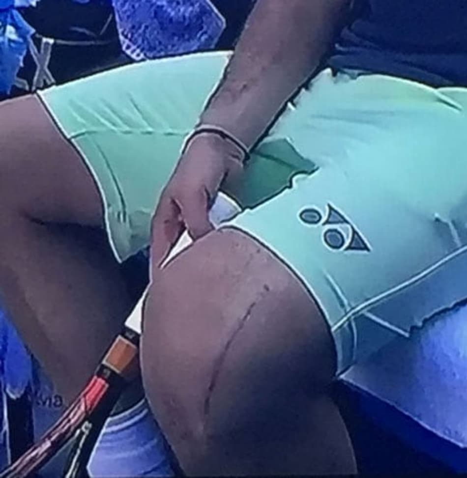 Com cicatriz no joelho, Wawrinka afirma que suportou bem as dores em retorno