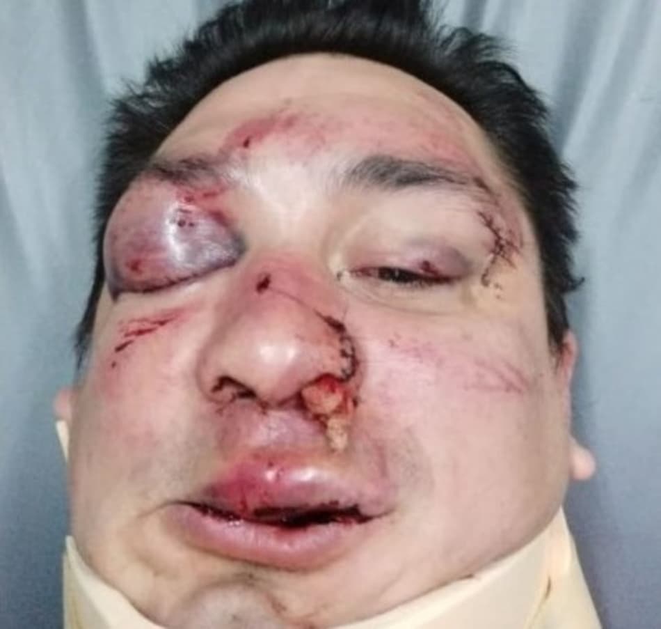 Jornalista é brutalmente agredido por torcedores na Argentina