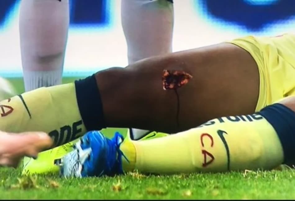 Após entrada violenta em ex-jogador do Barcelona, zagueiro é punido na Liga MX