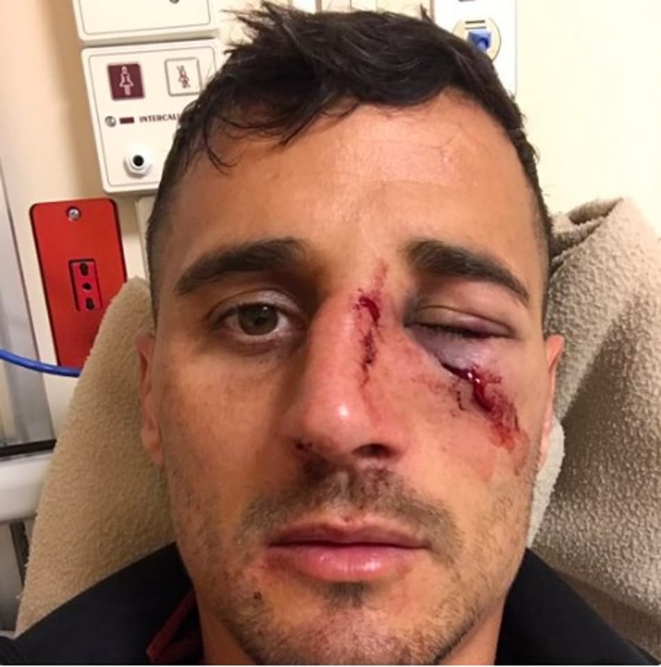 Com rosto ferido, jogador posta foto e alfineta arbitragem no Uruguai