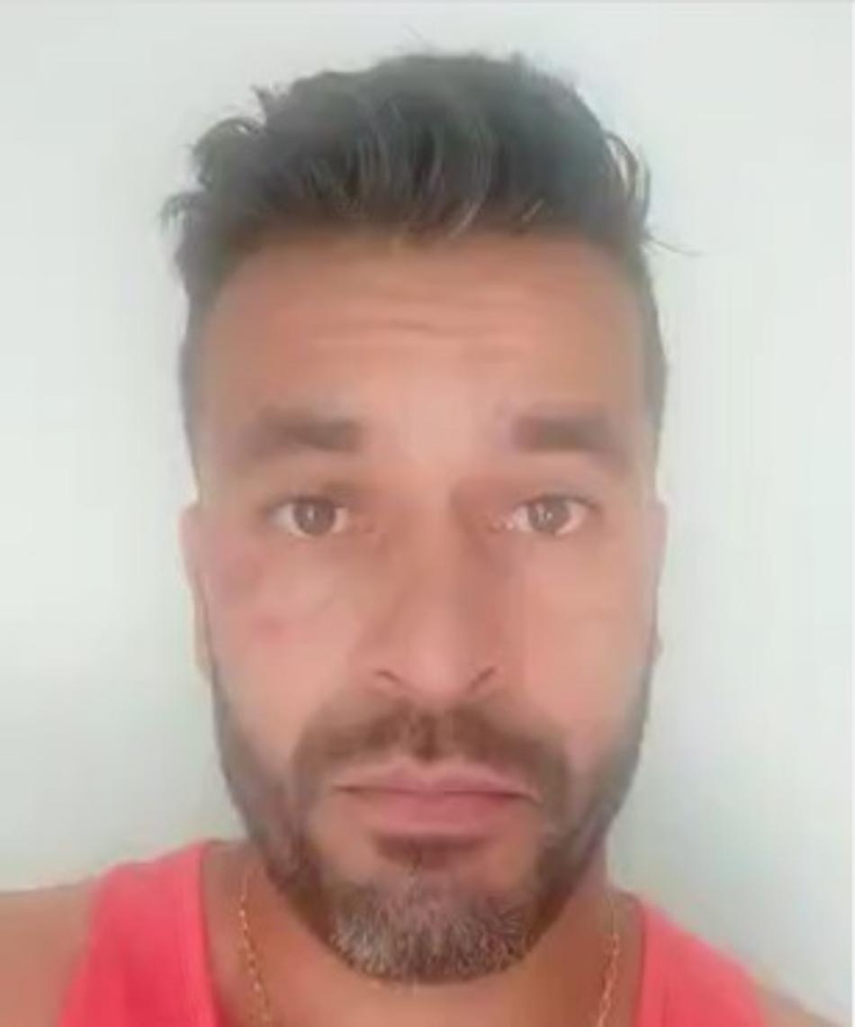 Goleiro do Avaí explica golpe em torcedor do Figueirense e chute no rosto