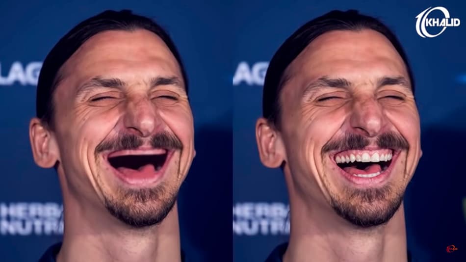 Banguelas? Brincadeira mostra os jogadores de futebol sem os dentes