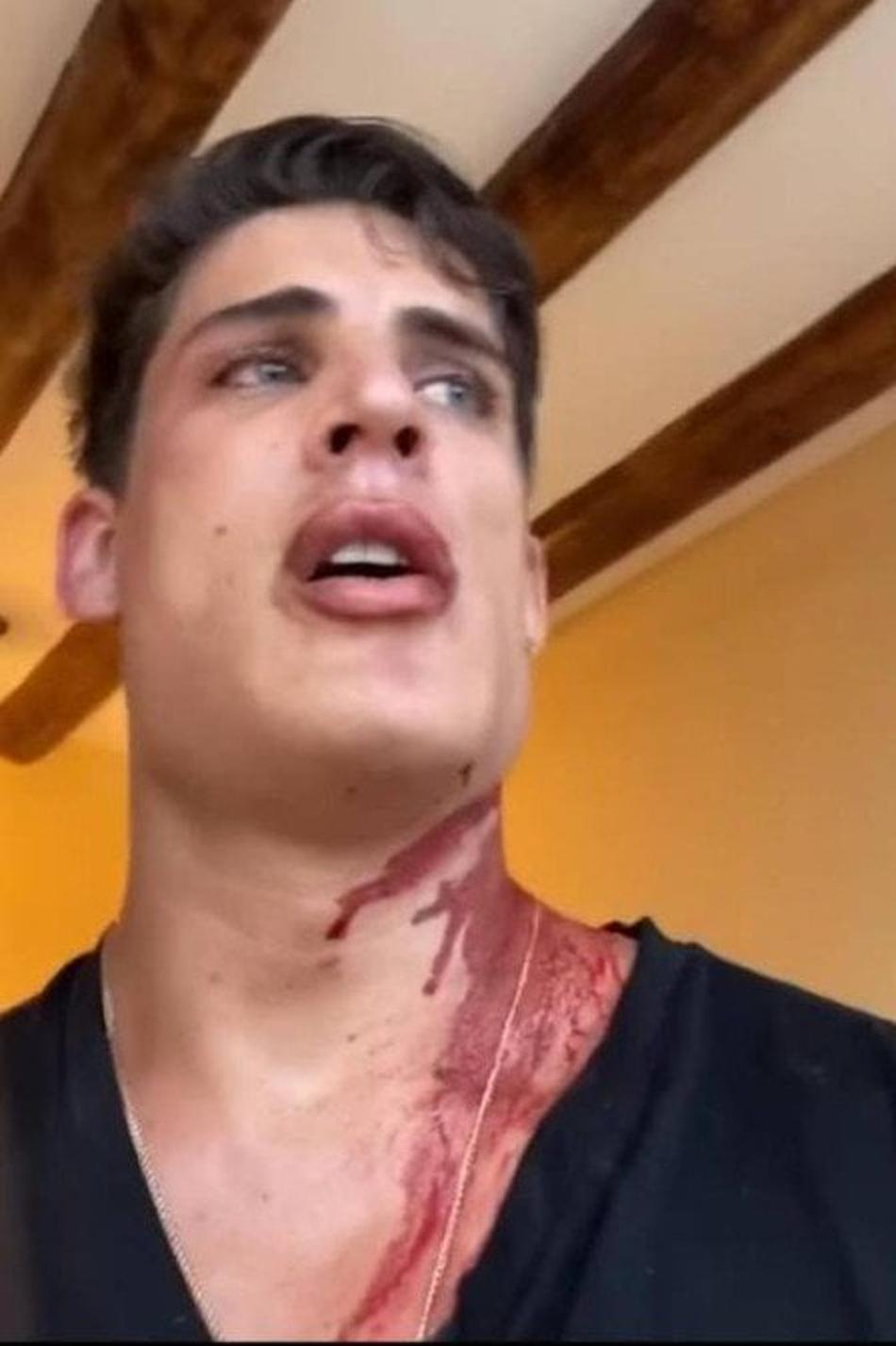 Affair de mãe de Neymar, Tiago Ramos faz post coberto de sangue e diz ter sido esfaqueado em Cancún