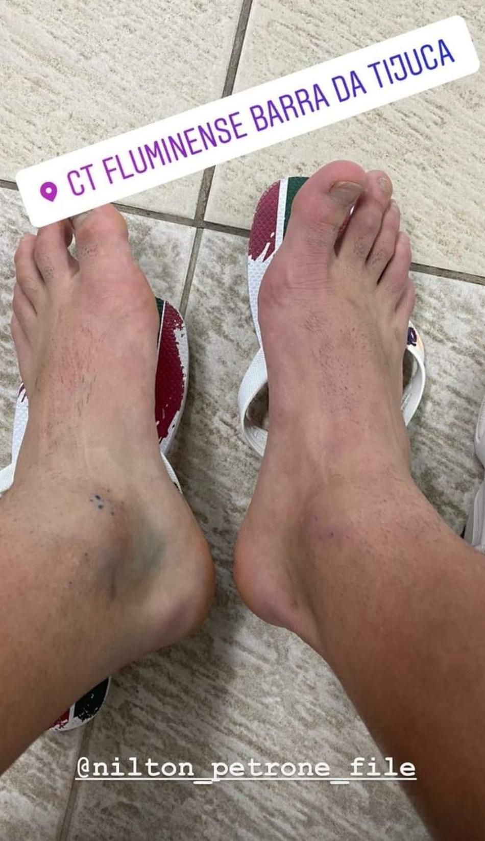 Yago Felipe comenta recuperação, projeta Copa do Brasil e diz que deseja permanecer no Fluminense