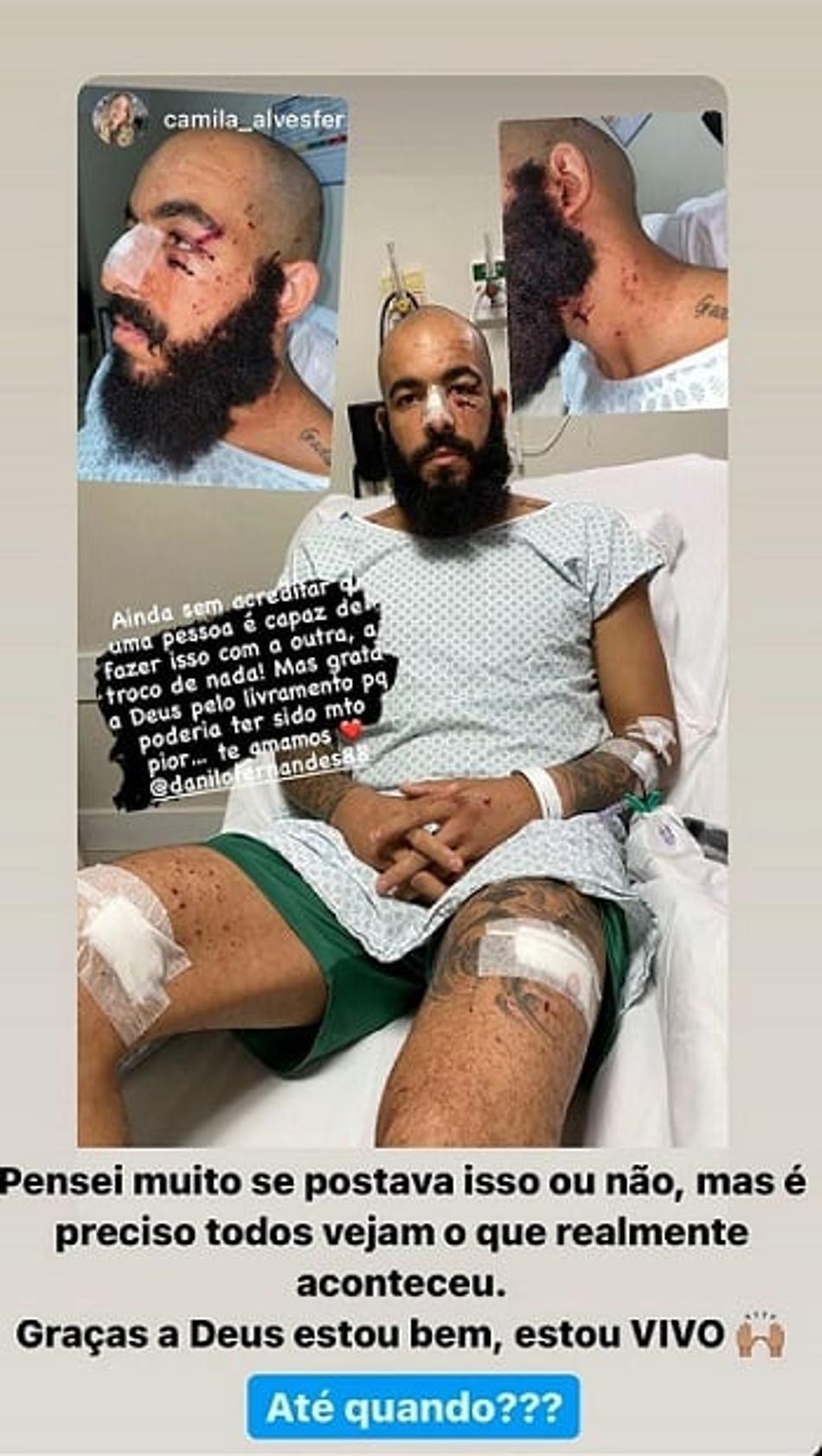 Esposa de Danilo Fernandes publica nova foto do goleiro após ataque ao ônibus do Bahia: 'Sem acreditar'