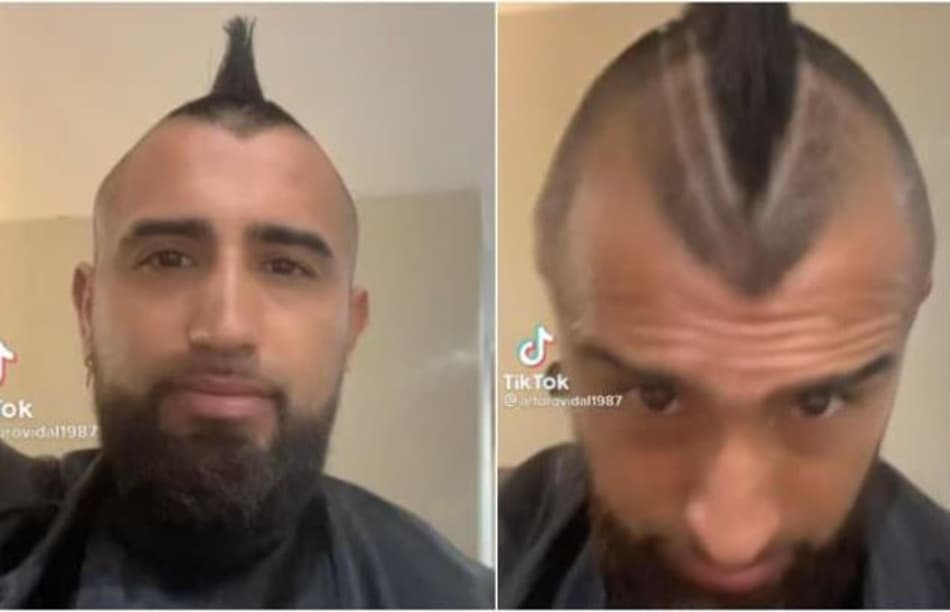 Ele não para! Vidal muda o visual e pede opinião dos seguidores