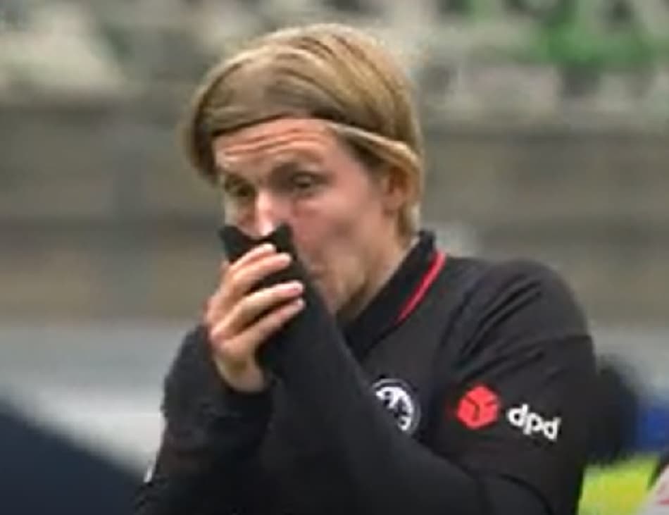 VÍDEO: Jogador alemão sofre fratura exposta na Bundesliga, e rival chora ao perceber gravidade