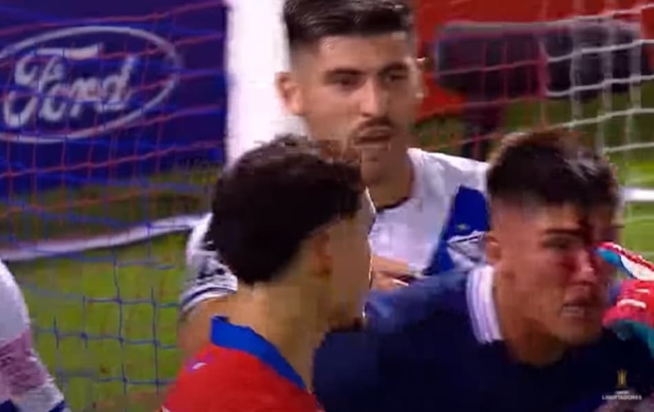 Na Libertadores, atacante deixa goleiro sangrando após choque