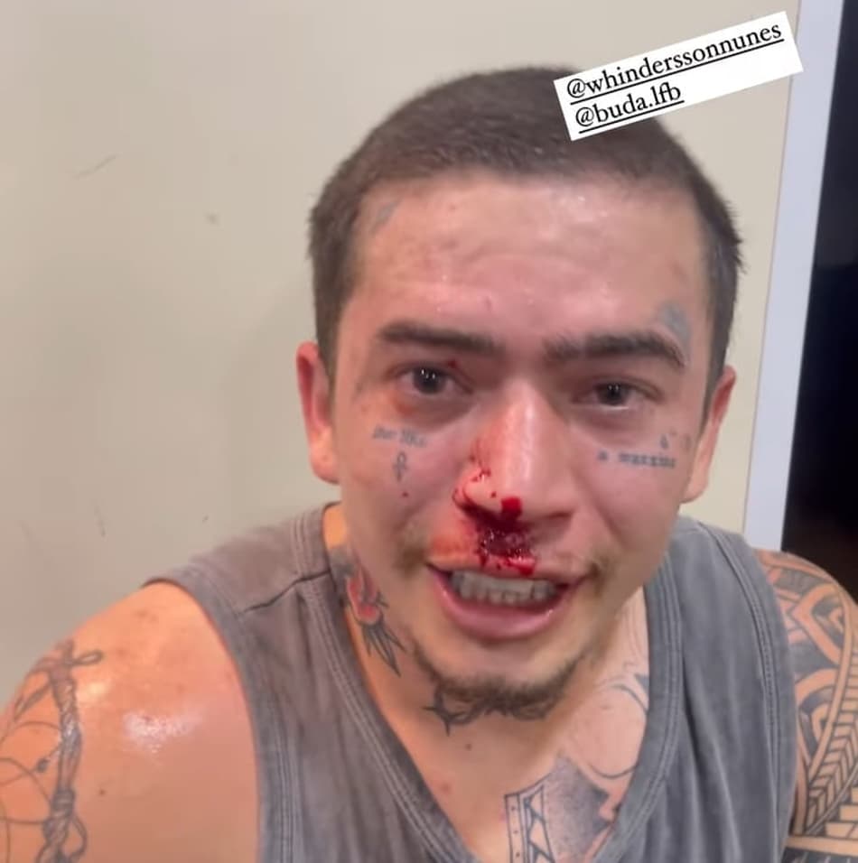 VÍDEO: Whindersson Nunes fica com nariz sangrando após treino de boxe