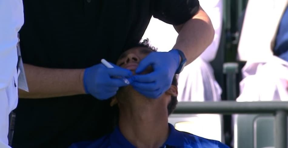 Felix Aliassime é atendido após dar raquetada no rosto