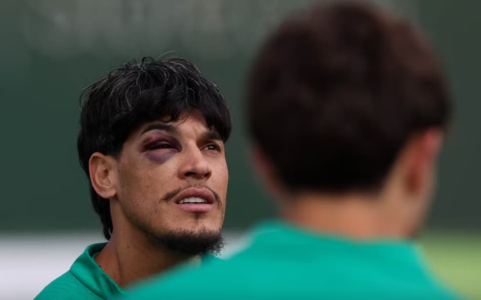 Gustavo Gómez com olho roxo durante treino do Palmeiras