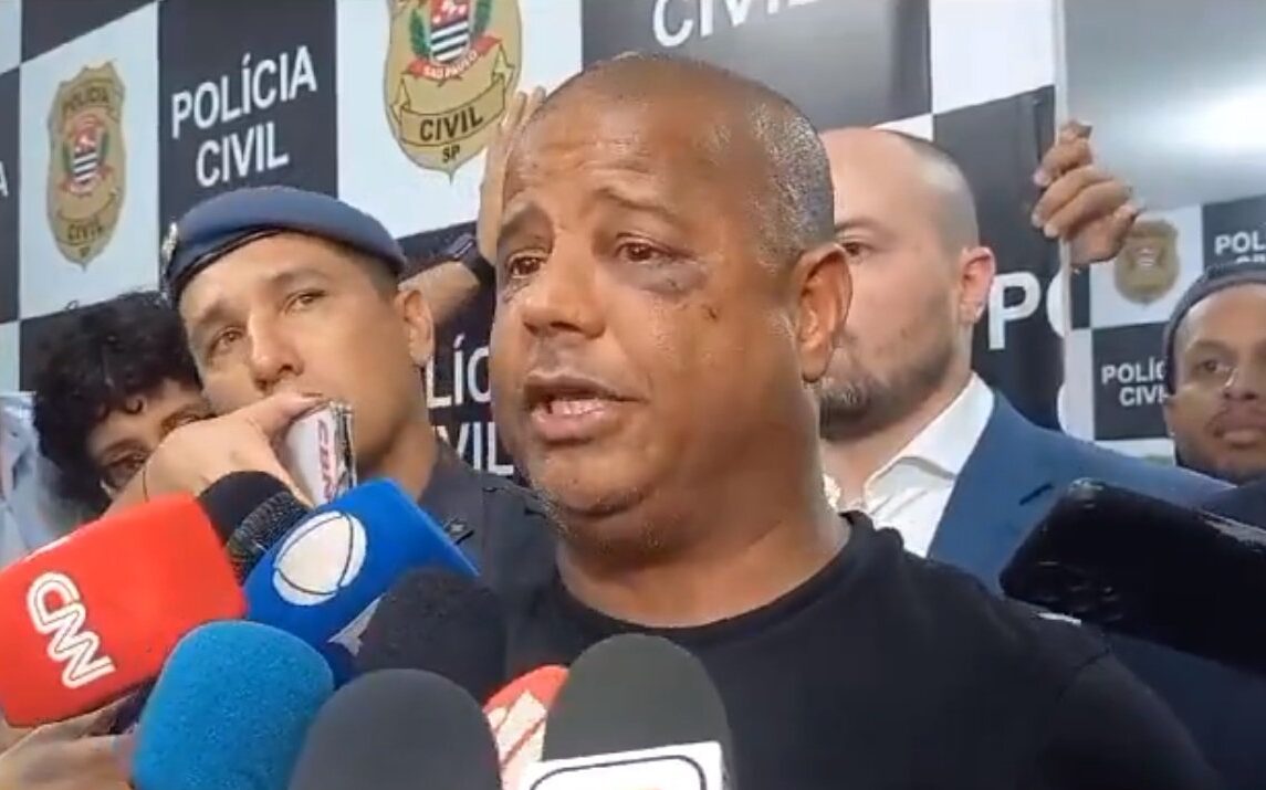 JOGO ABERTO PERNAMBUCO - AO VIVO 